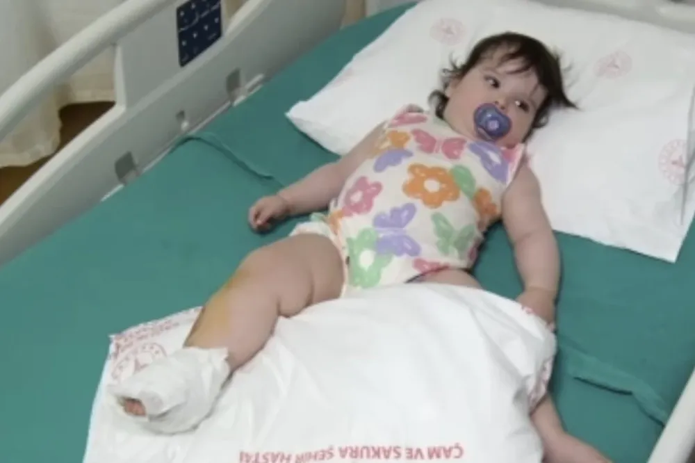 İstanbul’da Bebek Yanık Kazasıyla Yaralandı