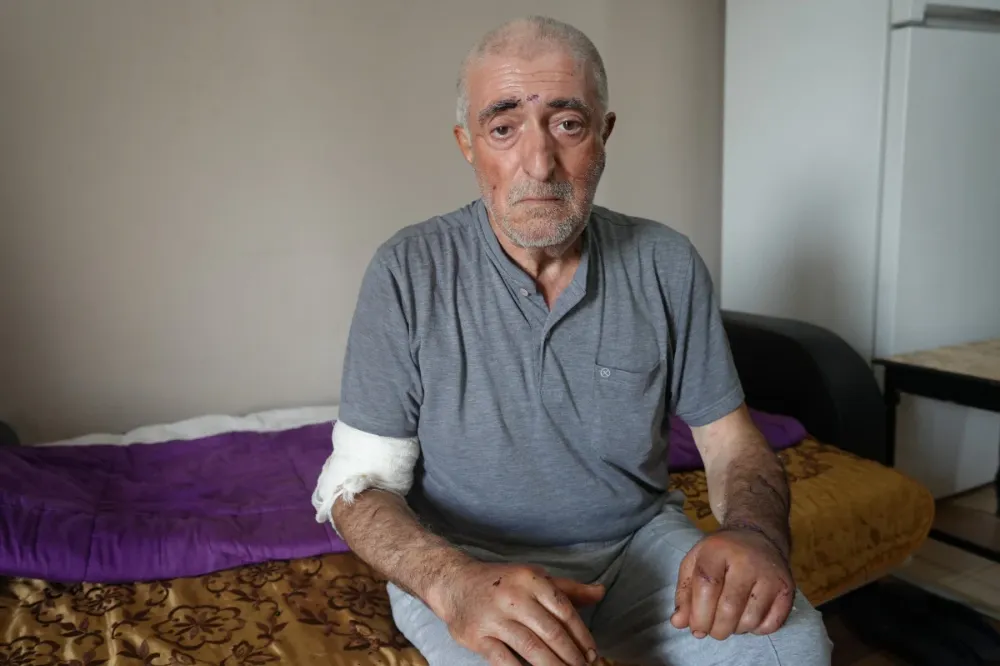 Antalya’da Barışma Vaadiyle Eve Çağırdığı Kocasını Uykusunda Bıçakladı