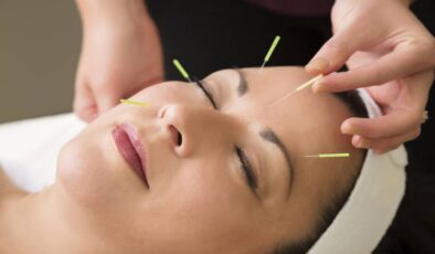 Akupunkturun mucizevi etkileri