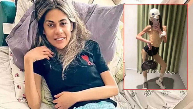 Nihal Candan Yoğun Bakımda: 29 Kiloya Düştü