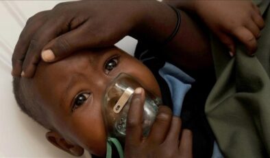 Gana’da M çiçeği hadise sayısı 133’e yükseldi